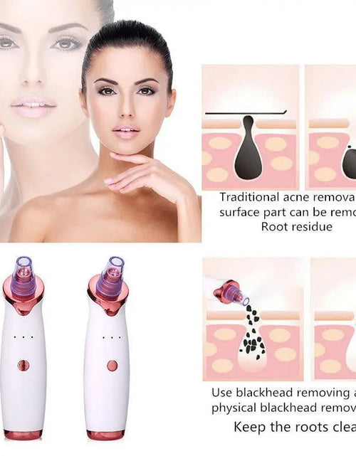 Load image into Gallery viewer, Blackhead Remover Instrument Black Dot Remover Acne Vacuum Suction Face Clean Black Head Pore Cleaning Beauty Skin Care Tool 2668south
