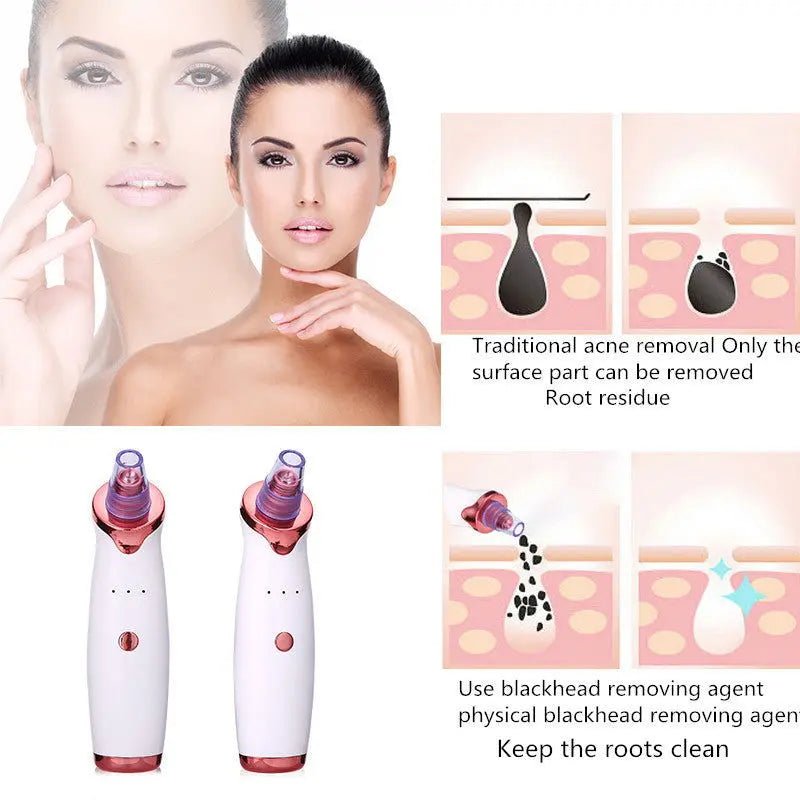 Blackhead Remover Instrument Black Dot Remover Acne Vacuum Suction Face Clean Black Head Pore Cleaning Beauty Skin Care Tool 2668south